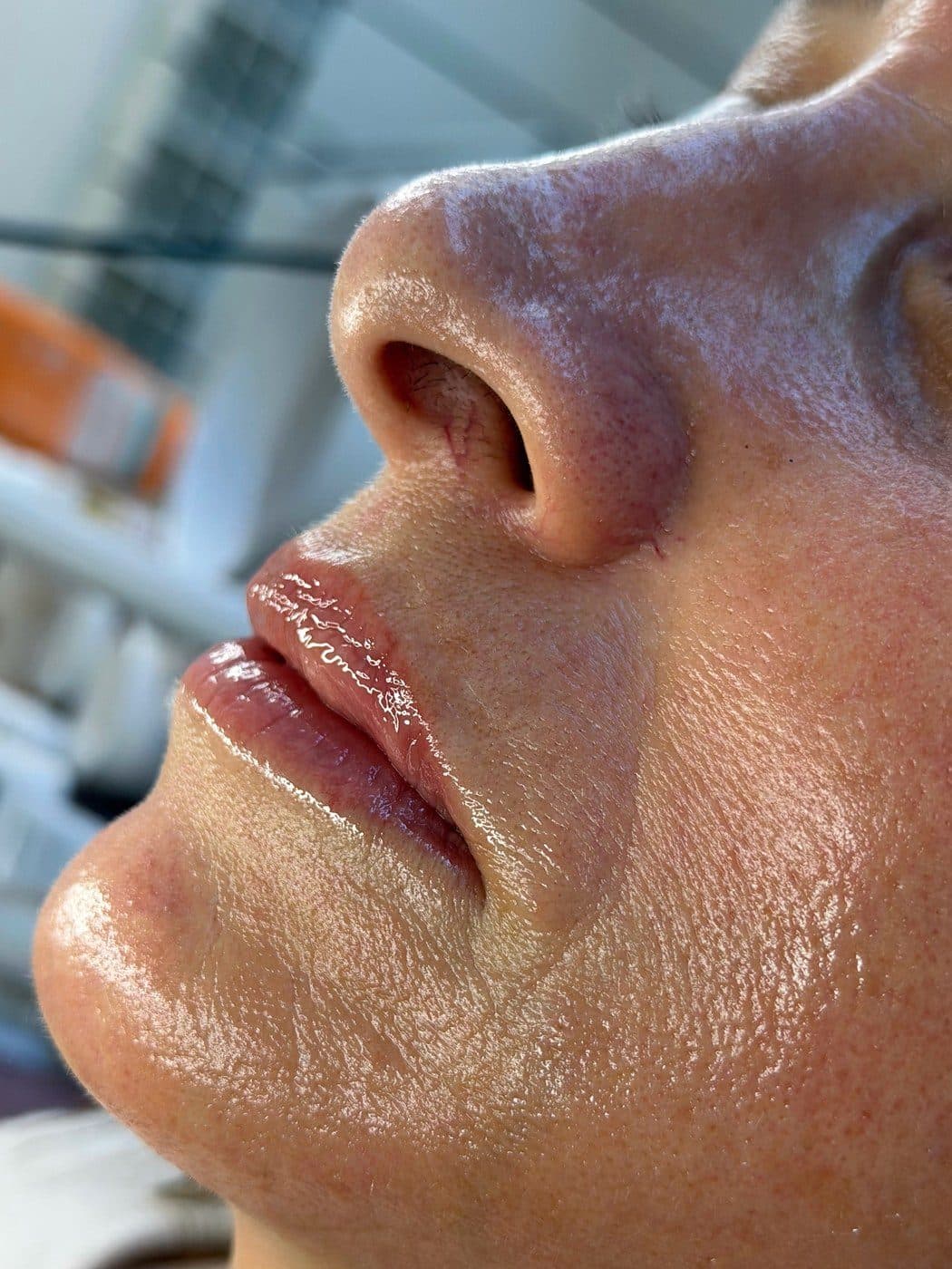 Piel luminosa en primer plano tras un tratamiento facial